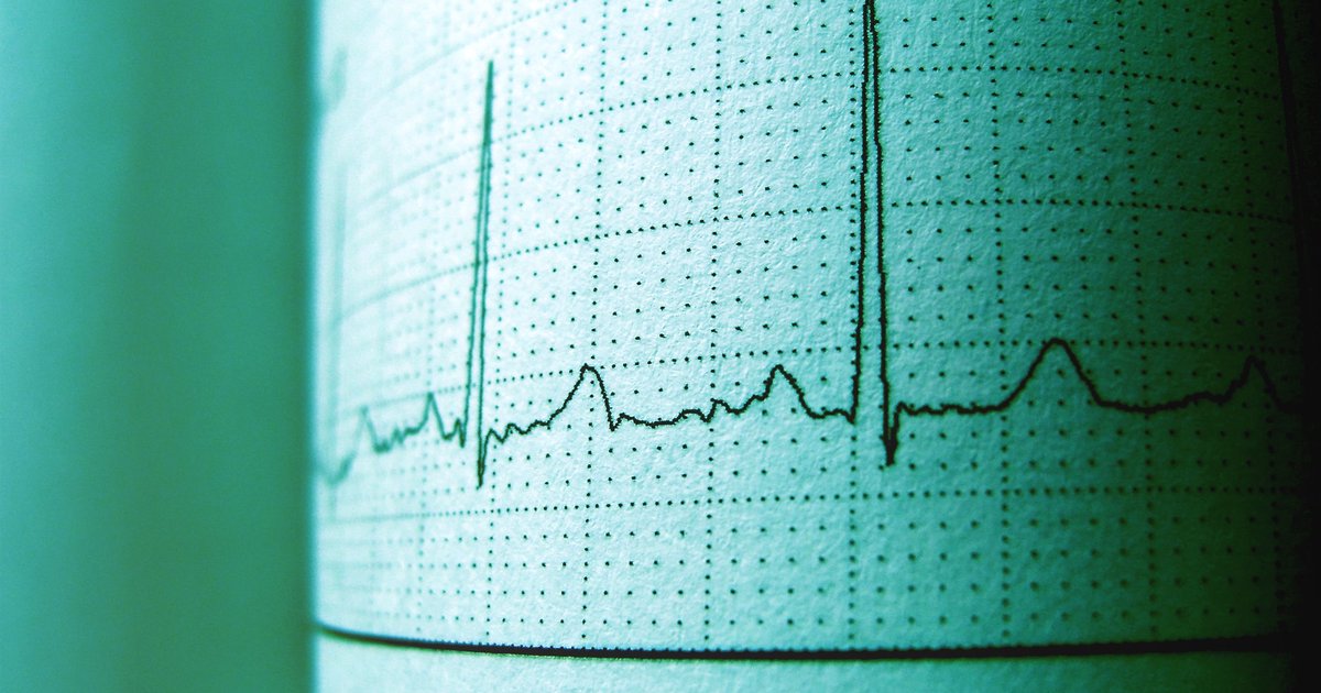 EKG schreiben Anleitung: Medizinische Grundlagen