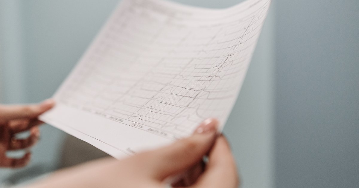 EKG schreiben Anleitung: Schritt für Schritt